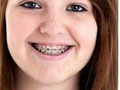 奇闻！英国14岁少女初试卫生棉后中毒身亡